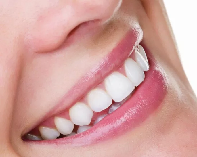 Teeth Whitening in Forest Hill & Dulwich