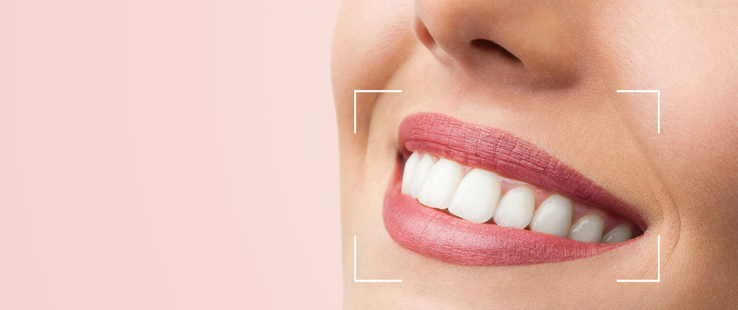 teeth whitening in forest hill and dulwich