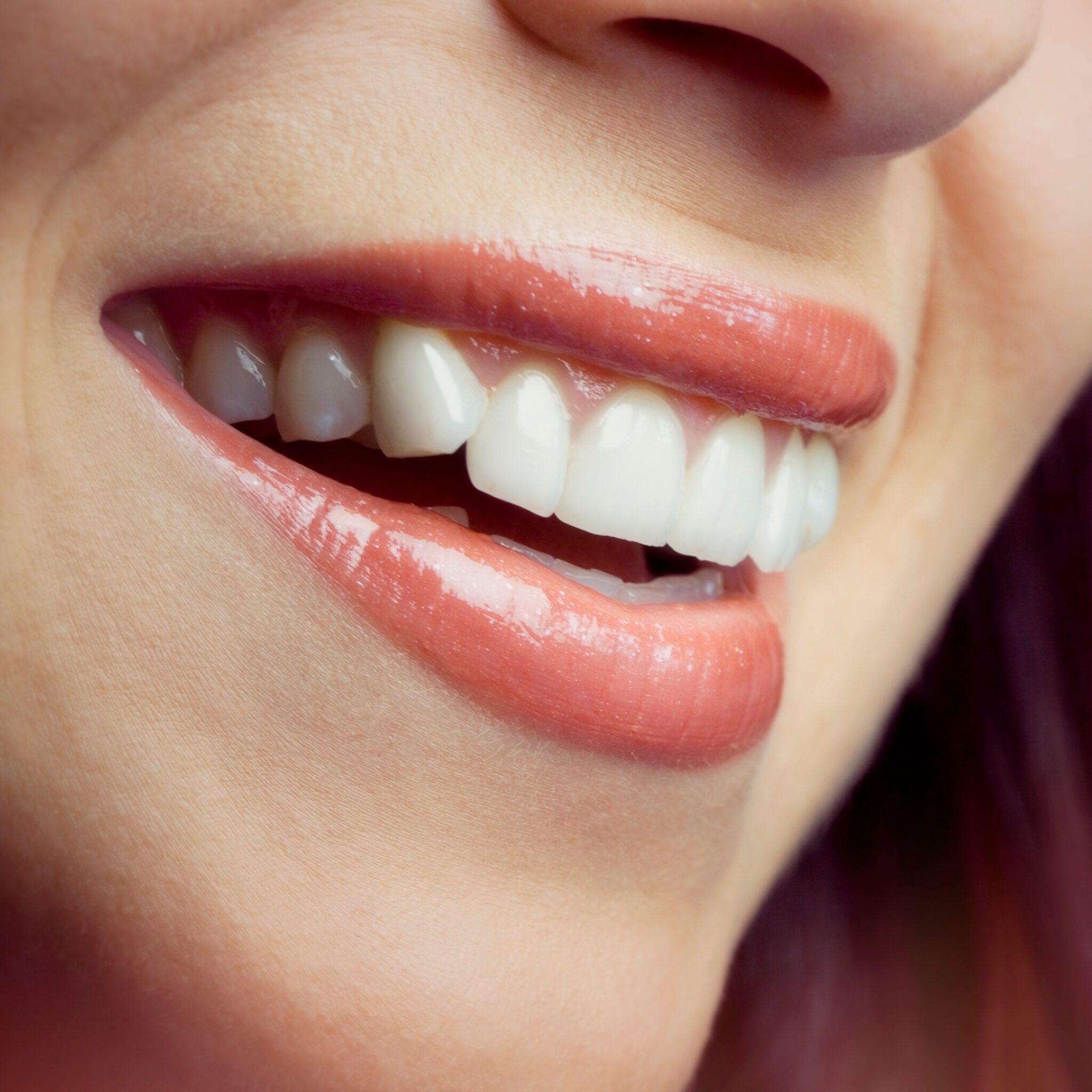 Why choose teeth whitening at London Dental Arts
