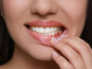 patient receiving gum disease in Forest Hill