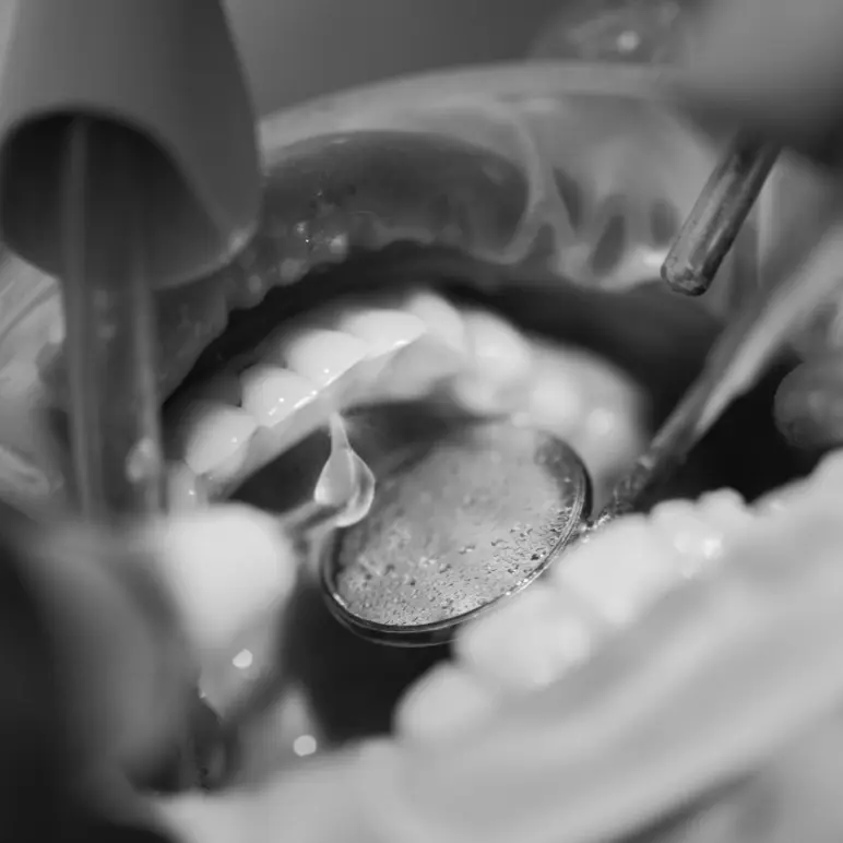 Hard and Soft Tissue Augmentation Hard and Soft Tissue Augmentation