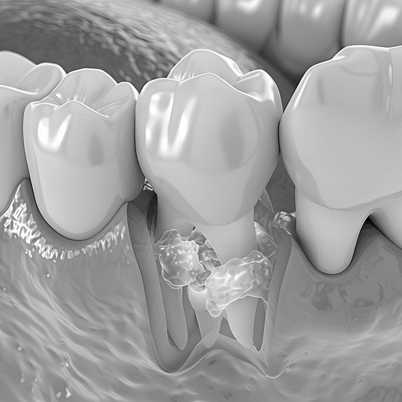 Management of Periodontal Disease