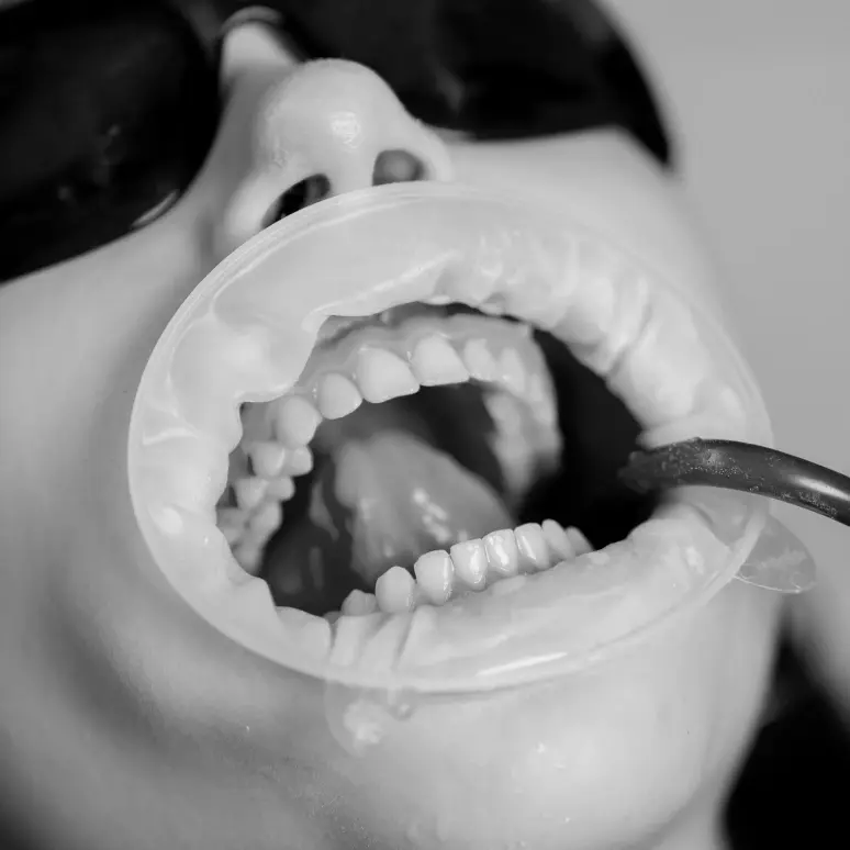 periodontal Regeneration