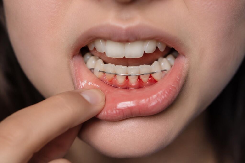 Dental Hygienist Forest Hill